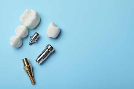 The different parts of your dental implants each incur their own costs