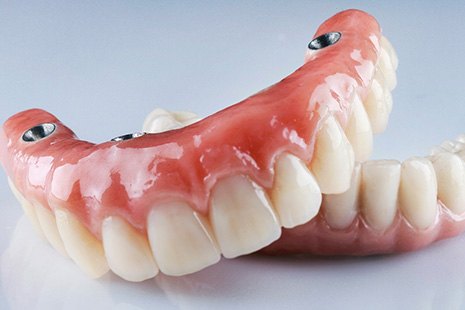 a pair of implant dentures
