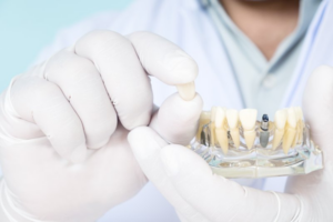 Dentist holding a dental implant crown and model