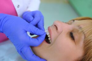 Patient having veneers placed on front teeth.